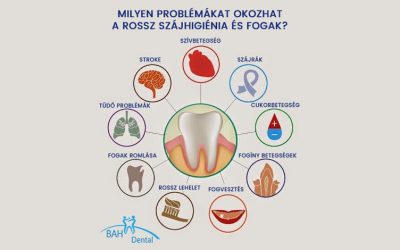 Gócbetegségek rossz fogak miatt