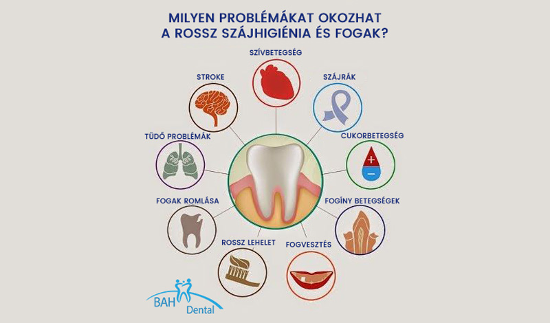 ízületek és fogak betegségei a térd milyen ízület