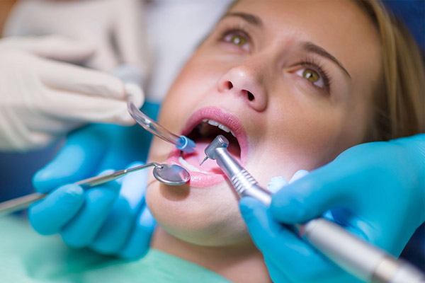fogszuvasodás kezelése BAHDental fogászat